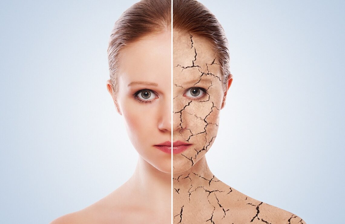 skin hydration