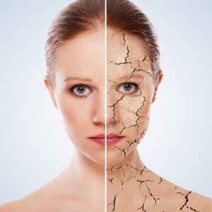 skin hydration